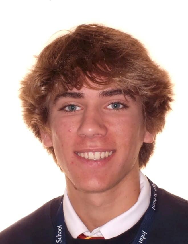 Teen's Before and After Orthodontics Photos in Carrollton Texas